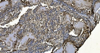 MIEF1 Antibody / Mitochondrial dynamics protein MID51
