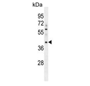 Western blot testing of human A549 cell lysate with MYBPHL antibody. Predicted molecular weight ~38 
