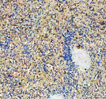 Immunohistochemical staining of NCR3 using anti-NCR3 antibody. NCR3 was detected in a paraffin-embed