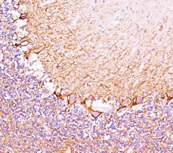 Neurofilament Antibody (-Heavy) / NF-H / NEFH