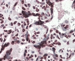 IHC testing of FFPE human placenta with HMGA1 antibody at 4ug/ml. HIER: steamed with pH6 citrate buf