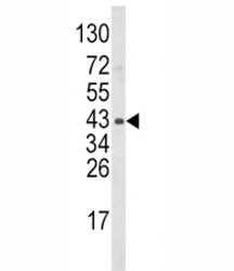 WNT5B Antibody