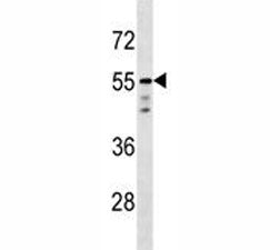 AKT1 antibody western blot analysis in T47D lysate
