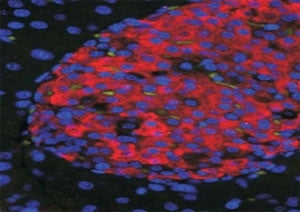 IHC/IF testing of FFPE islets in mouse pancreas with UNC5C antibody at 50ug/ml (red) and DAPI nuclea
