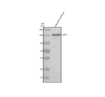 Western blot analysis of Upf1 protein using Upf1 antibody and zebrafish embryo tissue lysate. The pr