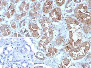 IHC staining of FFPE human kidney tissue with FABP1 antibody (clone FABP1/4462). HIER: boil tissue s