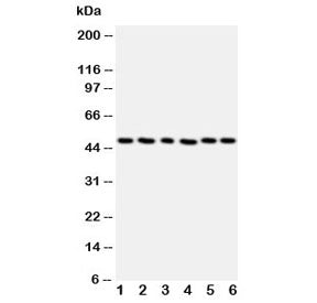 Western blot testing of HDAC3 antibody and Lane 1: rat stomach; 2: rat testis; 3: MCF-7; 4: HeLa; 5: