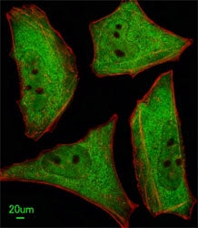 Immunofluorescent analysis of HeLa cells using Ubiquilin1 antibody; Ab was diluted at 1:100 dilution