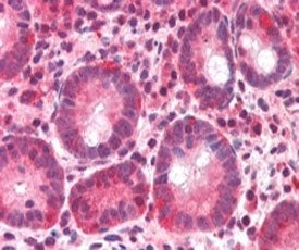 IHC testing of FFPE human small intestine with BAZ2B antibody at 5ug/ml. HIER: steamed with pH6 citr