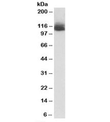 Western blot testing of mouse liver lysate with Nlrp12 antibody at 1ug/ml. Predicted molecular weigh
