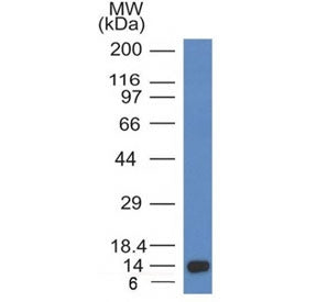 ALK Antibody / Anaplastic Lymphoma Kinase