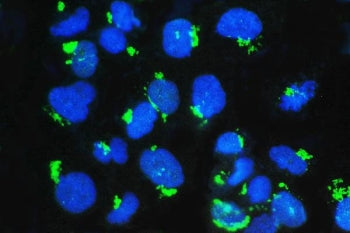 Immunofluorescent staining of FFPE human U-2 OS cells with GM130 antibody (green) and DAPI nuclear s