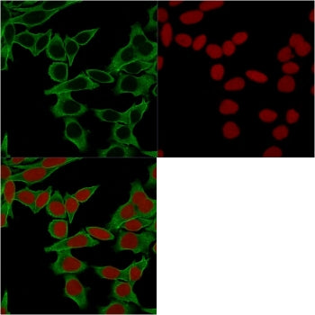 Immunofluorescent staining of MeOH fixed human HeLa cells with Spectrin beta III antibody (clone SPT