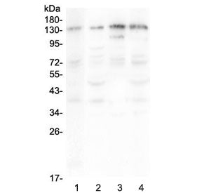 Western blot testing of human 1) A375, 2) HepG2, 3) Jurkat and 4) PANC-1 lysate with EPS15 antibody 