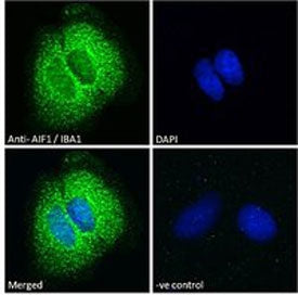 Immunofluorescent staining of FFPE human Caco-2 cells with IBA1 antibody (green) at 10ug/ml and DAPI