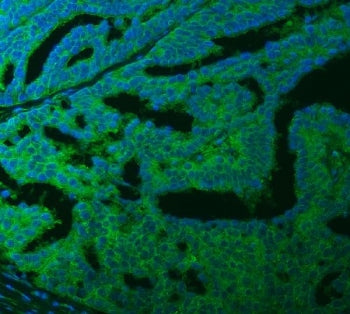 Ferroportin 1 Antibody / FPN / SLC40A1