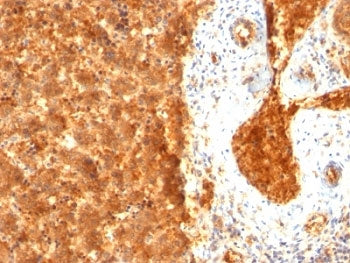 Alpha Fetoprotein / AFP Antibody