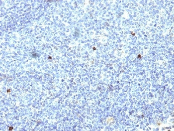 HLA-Aw32 + HLA-A25 Antibody