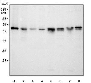 Western blot testing of 1) human SH-SY5Y, 2) human RT4, 3) human MCF7, 4) human K562, 5) rat pancrea