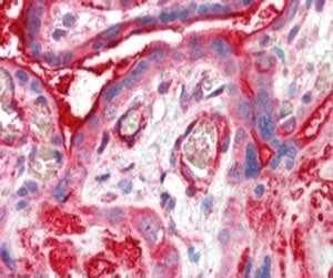 IHC testing of FFPE human placenta with ADAP2 antibody at 5ug/ml. HIER: steamed with pH6 citrate buf