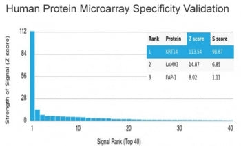 Analysis of HuProt(TM) microarray containing more than 19,000 full-length human proteins using CK14 