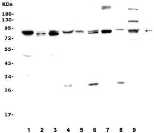 Western blot testing of 1) rat brain, 2) rat kidney, 3) rat lung, 4) rat liver, 5) mouse brain, 6) m