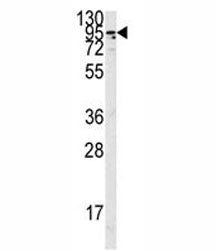 Western blot analysis of the Angiotensin-converting enzyme 2 antibody in K562 lysate. Predicted mole