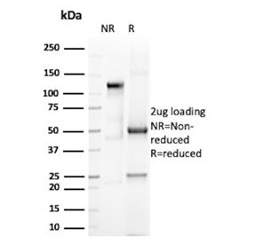 SDS-PAGE analysis of purified, BSA-free Eosinophil peroxidase antibody (clone AHE-1) as confirmation