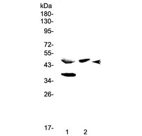 Western blot testing of 1) rat pancreas and 2) mouse pancreas lysate with Carboxypeptidase A antibod