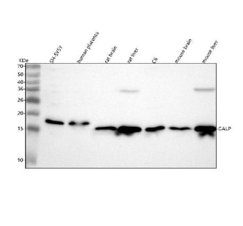 Western blot analysis of GALP using anti-GALP antibody. Lane 1: human SH-SY5Y whole cell lysates, La