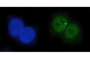 EAP2 Antibody / ETS1 associated protein II / Tyrosyl-DNA phosphodiesterase 2
