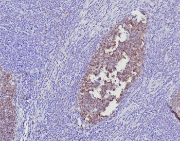 IHC staining of FFPE human tonsil tissue with BOB1 antibody (clone BOB1/7468). HIER: boil tissue sec