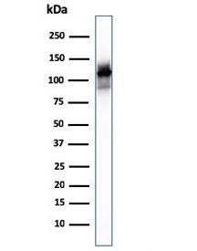 Western blot testing of human skeletal muscle lysate with Sarcomeric Alpha Actinin antibody (clone A