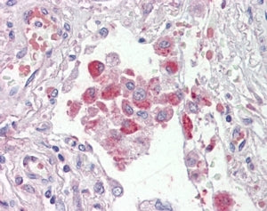 IHC testing of FFPE human lung with OSBPL9 antibody at 2.5ug/ml. HIER: steamed with pH6 citrate buff