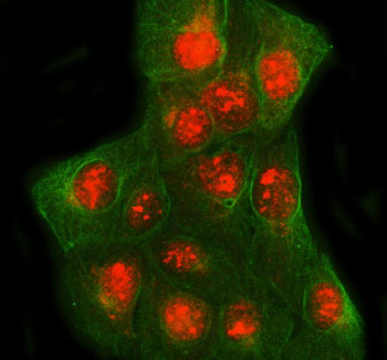 Immunofluorescent staining of SPIDR using anti-SPIDR antibody (red) and anti-Beta Tubulin antibody (