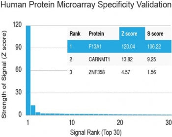 Protein array validation of the Factor XIIIa antibody: Analysis of HuProt(TM) microarray containing 