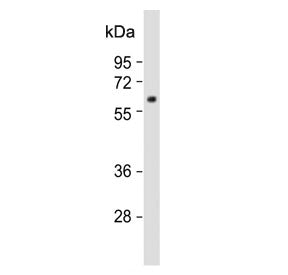 Western blot testing of human HepG2 cell lysate with MPP3 antibody. Predicted molecular weight ~66 k