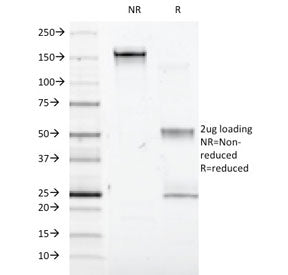 SDS-PAGE analysis of purified, BSA-free IFNA1 antibody (clone 2.48) as confirmation of integrity and