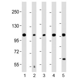 Western blot testing of human 1) COLO 205, 2) brain, 3) HeLa, 4) MCF7 and 5) SH-SY5Y lysate with KCN