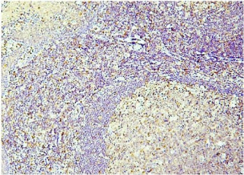 IHC staining of FFPE human tonsil with Caspase 3 antibody. HIER: boil tissue sections in pH8 EDTA fo