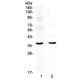 Western blot testing of 1) rat lung and 2) mouse lung lysate with SPARC antibody at 0.5ug/ml. Expect