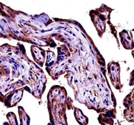 C9 antibody immunohistochemistry analysis in formalin fixed and paraffin embedded human placenta tis