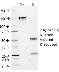 Interferon alpha 2 Antibody / IFNA2