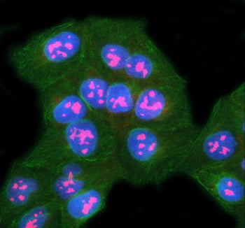 Immunofluorescent staining of SURF6 using anti-SURF6 antibody (red) and anti-Beta Tubulin antibody (