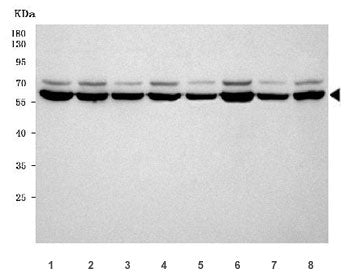 Western blot testing of 1) human HeLa, 2) human 293T, 3) human Jurkat, 4) human MCF7, 5) rat brain, 