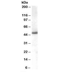 Western blot testing of Jurkat lysate with SNX5 antibody at 1ug/ml. Predicted/observed molecular wei