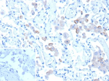 IHC staining of FFPE human lung tissue with Mannose Receptor antibody (clone MRC1/9457). Inset: PBS 