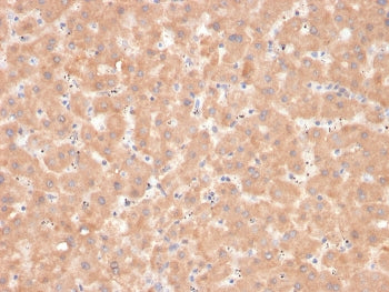 Factor VII Antibody