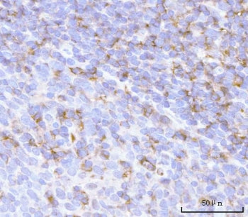 IHC staining of FFPE human tonsil tissue with PRTN3 antibody. HIER: boil tissue sections in pH8 EDTA