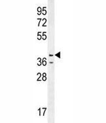 Caspase-12 Antibody, 0.08ml
